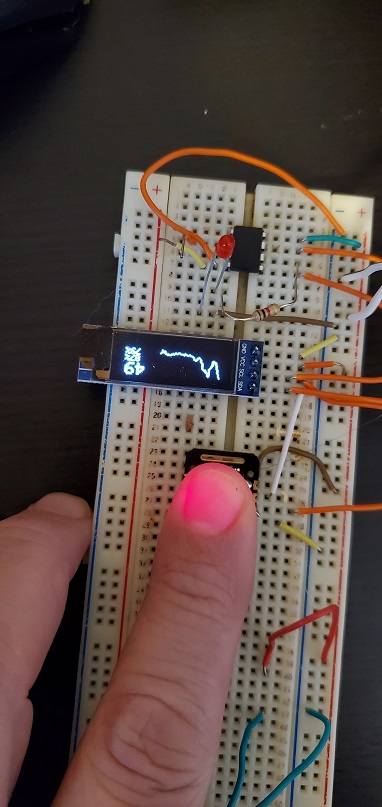 microcontroler